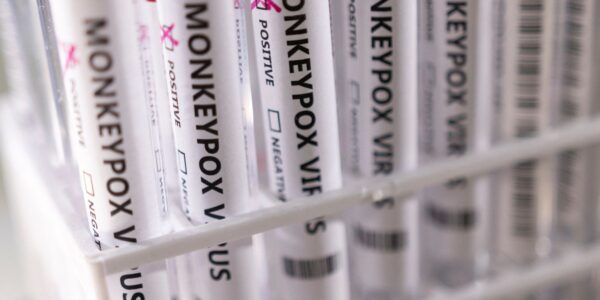 2022-05-23t222423z_1_lynxnpei4m100_rtroptp_4_health-monkeypox_1.jpg
