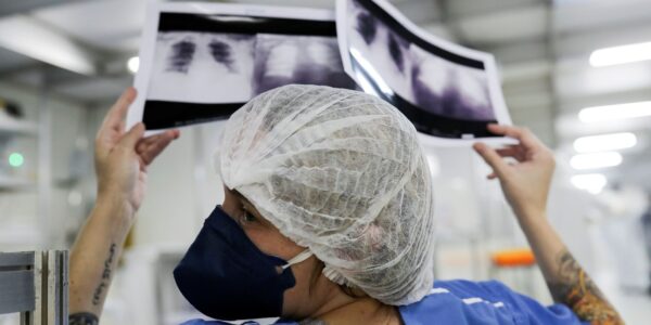 radiografia_de_torax_coronaviruscovid-19_hospital_sao_paulo1205200325.jpg