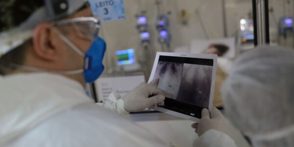 radiografia_de_torax_coronaviruscovid-19_hospital_sao_paulo1205200326.jpg